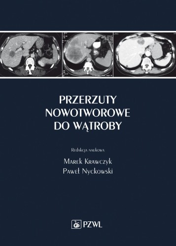 Przerzuty nowotworowe do wątroby, Marek Krawczyk
