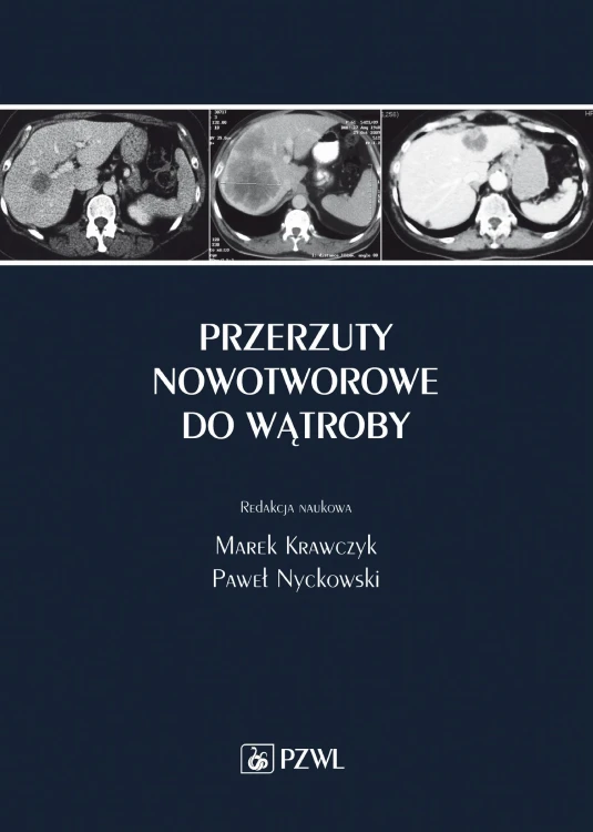 Przerzuty nowotworowe do wątroby, Marek Krawczyk