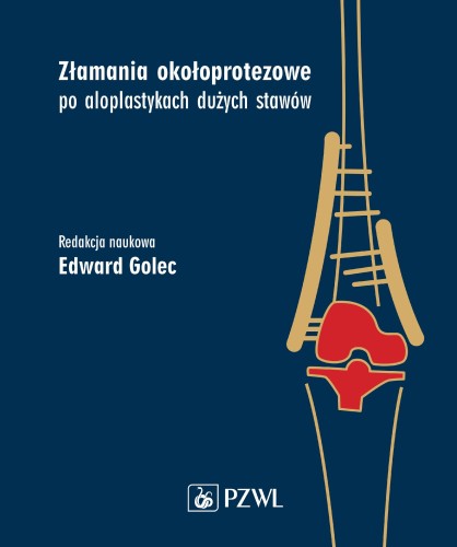 Złamania okołoprotezowe po aloplastykach...