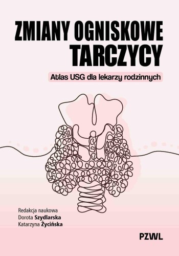 Zmiany ogniskowe tarczycy. Atlas USG dla...