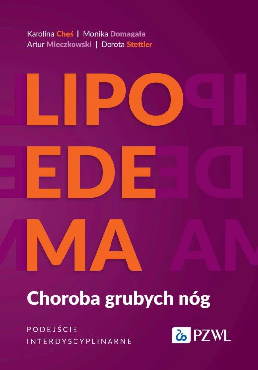 Lipoedema. Choroba grubych nóg. Podejście...