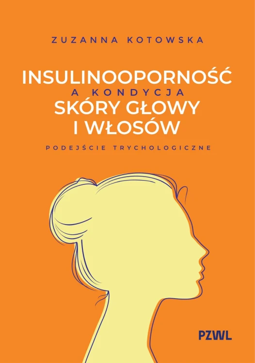Insulinooporność a kondycja skóry głowy i...